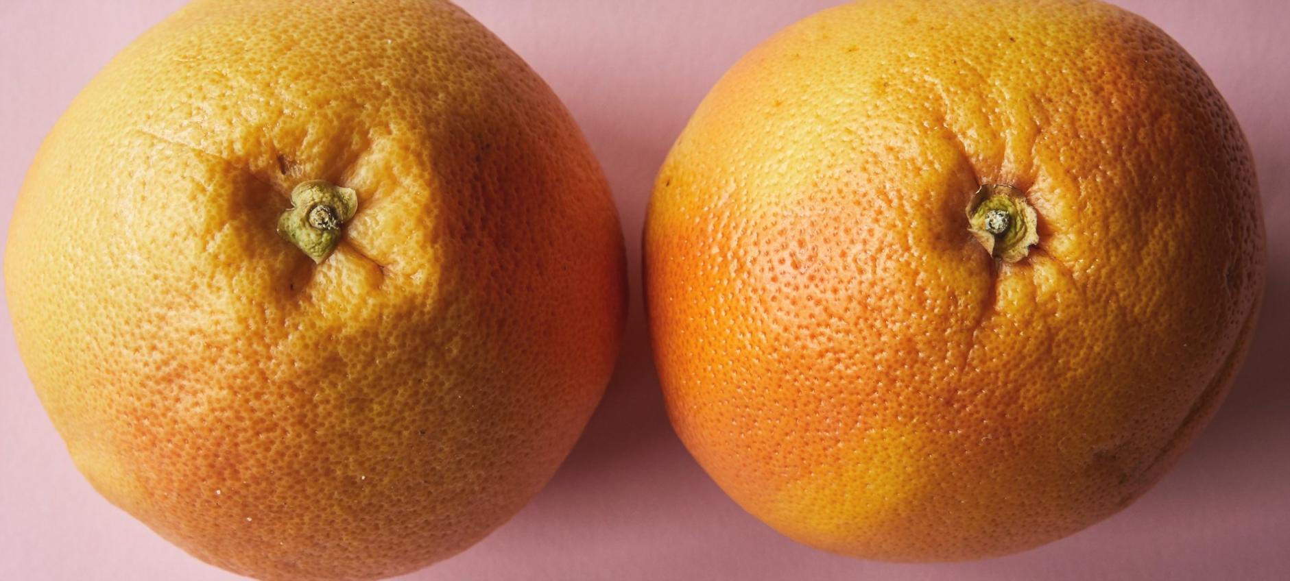 Sesja warsztatowa analizująca komponenty zdrowej diety